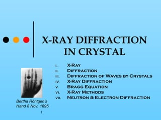 X-RAY DIFFRACTION
IN CRYSTAL
I.
II.
III.
IV.
V.
VI.

Bertha Röntgen’s
Hand 8 Nov, 1895
1

VII.

X-Ray
Diffraction
Diffraction of Waves by Crystals
X-Ray Diffraction
Bragg Equation
X-Ray Methods
Neutron & Electron Diffraction

 