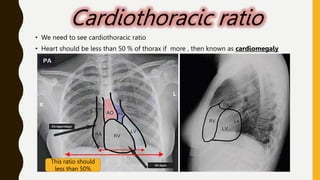 x-ray ppt made bye Dr nishant this is the best pdf to understand x ray ...