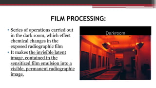 X-ray film: Physical characterstics and Film processing | PPTX