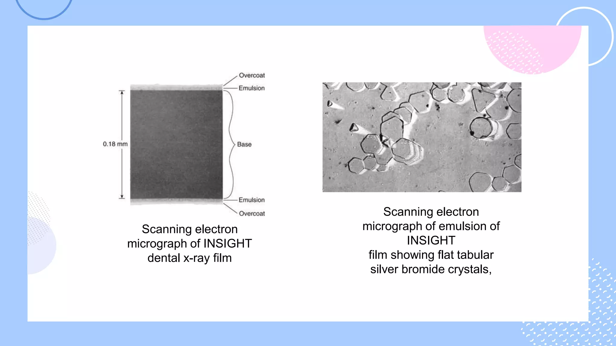 Dental XRay Film types and indications. PPT
