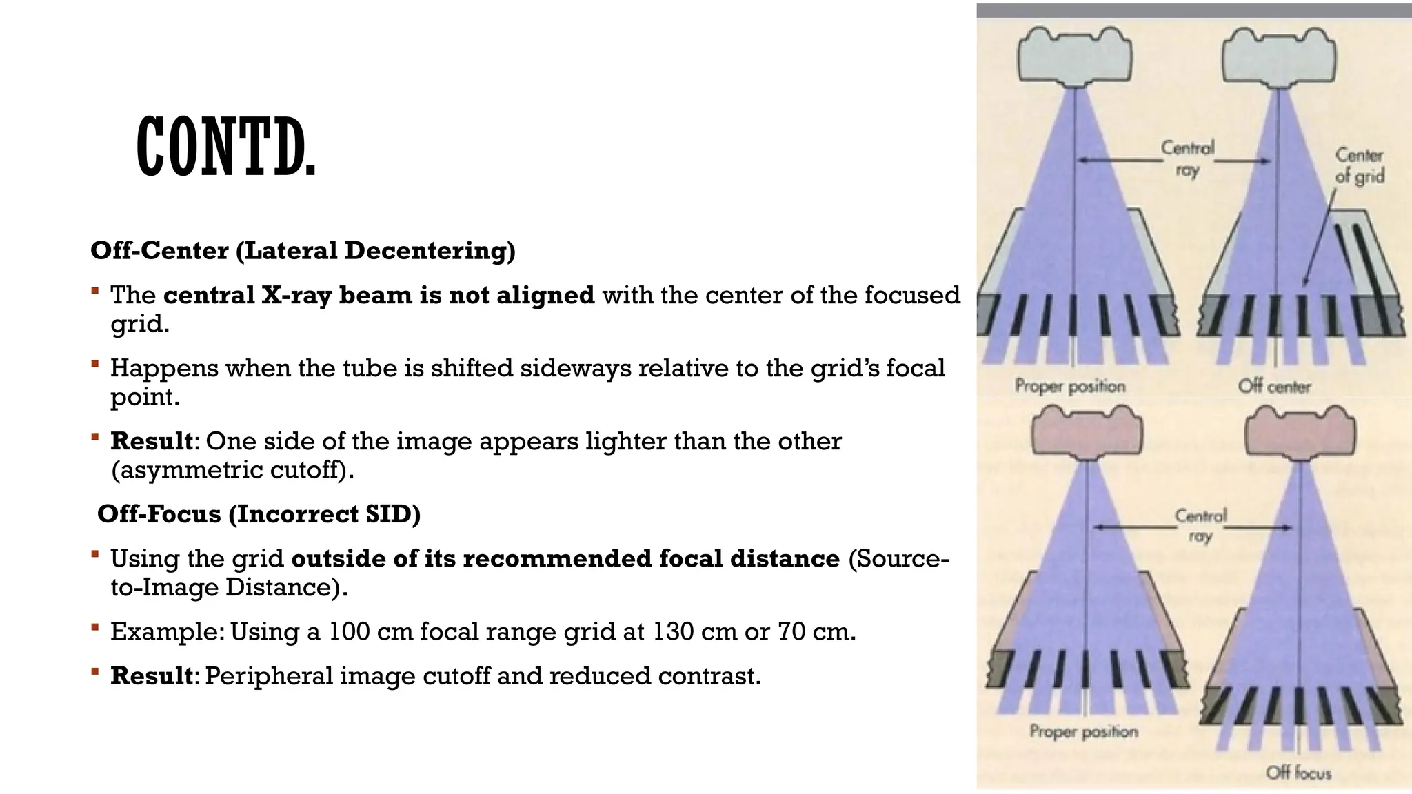 CONTD.
Off-Center (Lateral Decentering)
 The central X-ray beam is not aligned with the center of the focused
grid.
 Happens when the tube is shifted sideways relative to the grid’s focal
point.
 Result: One side of the image appears lighter than the other
(asymmetric cutoff).
Off-Focus (Incorrect SID)
 Using the grid outside of its recommended focal distance (Source-
to-Image Distance).
 Example: Using a 100 cm focal range grid at 130 cm or 70 cm.
 Result: Peripheral image cutoff and reduced contrast.
 