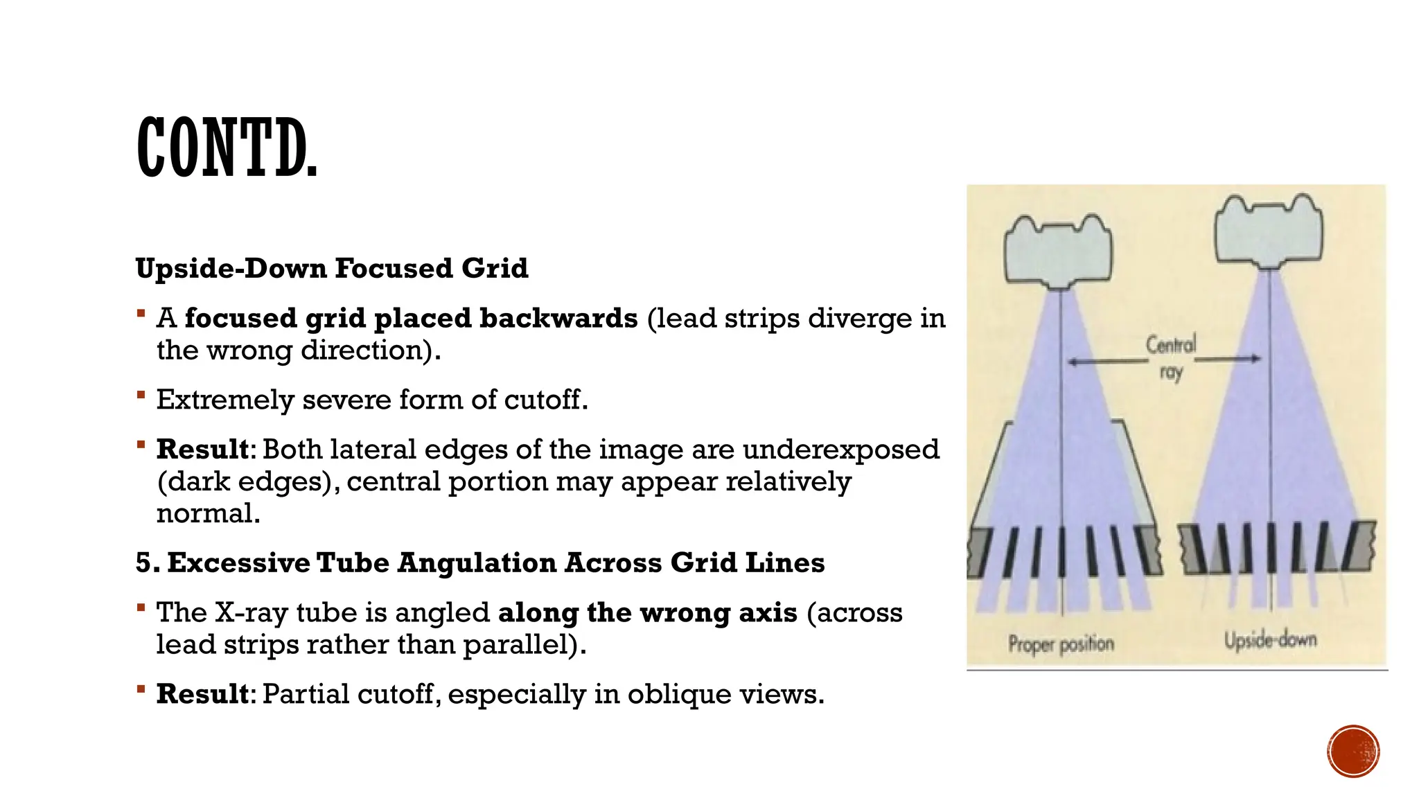 CONTD.
Upside-Down Focused Grid
 A focused grid placed backwards (lead strips diverge in
the wrong direction).
 Extremely severe form of cutoff.
 Result: Both lateral edges of the image are underexposed
(dark edges), central portion may appear relatively
normal.
5. Excessive Tube Angulation Across Grid Lines
 The X-ray tube is angled along the wrong axis (across
lead strips rather than parallel).
 Result: Partial cutoff, especially in oblique views.
 