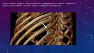 X-ray images of lung diseases (pneumonia, tuberculosis, and tumors)..pptx