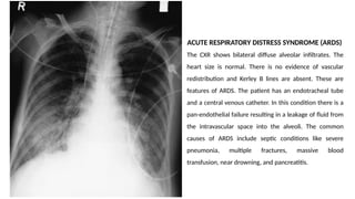 X-Ray Imaging Technique and Interpretation for Physiotherapists.pptx