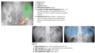 Normal Rug X Ray X-Ray Imaging Technique and Interpretation for Physiotherapists.pptx