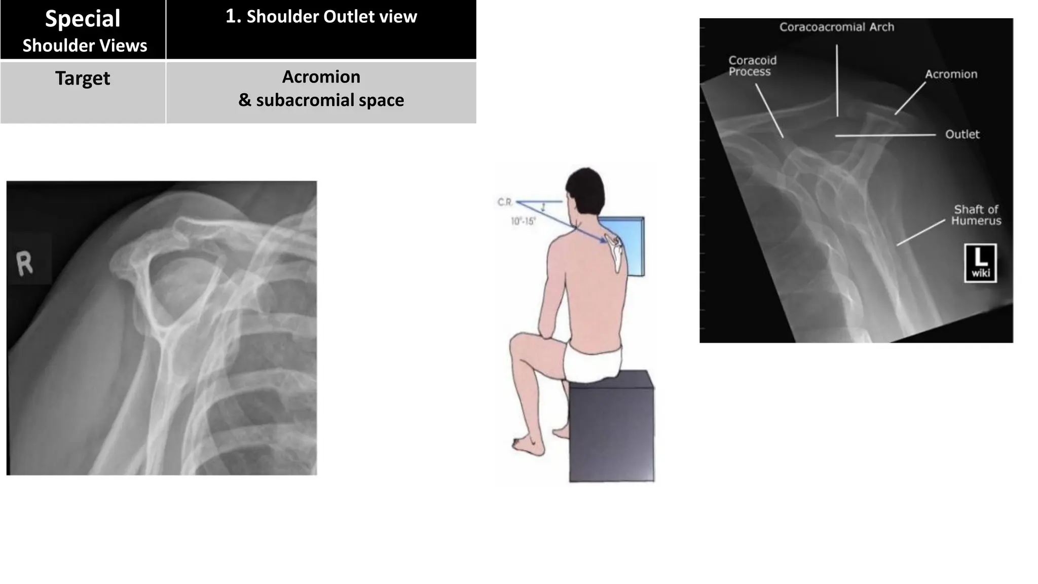 Axillary Radiograph Position X-ray Joints imaging positions by dr. Eman Hamed | PDF