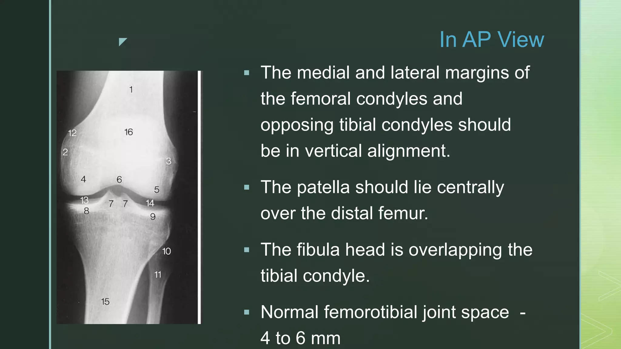 X ray knee joint | PPTX