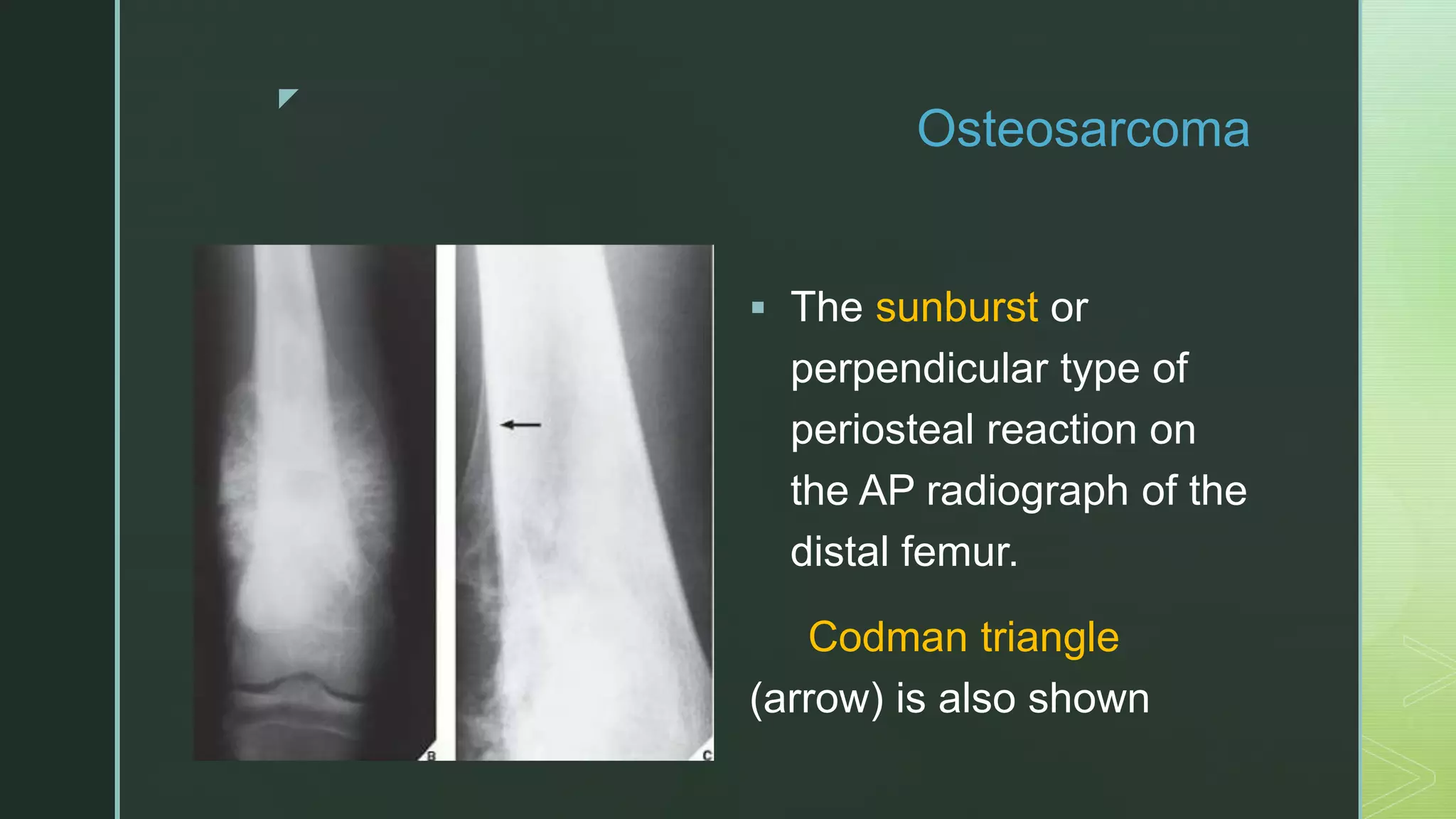 X ray knee joint | PPTX