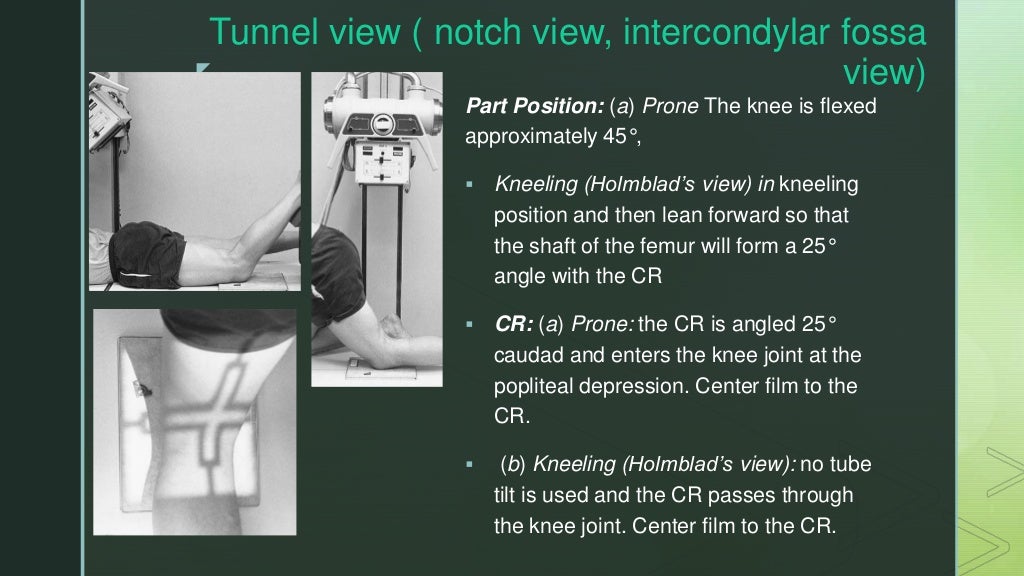 X ray knee joint