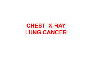 CHEST X-RAY
LUNG CANCER
 