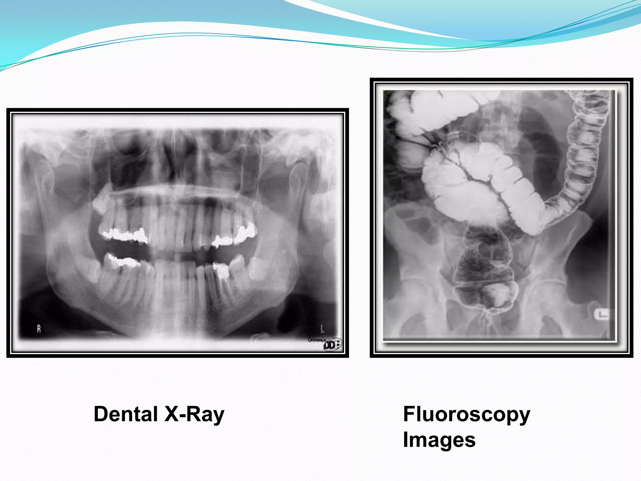 Dental X-Ray   Fluoroscopy
               Images
 