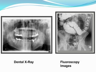 Dental X-Ray   Fluoroscopy
               Images
 