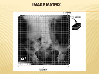 X ray machines - conventional and digital | PPTX