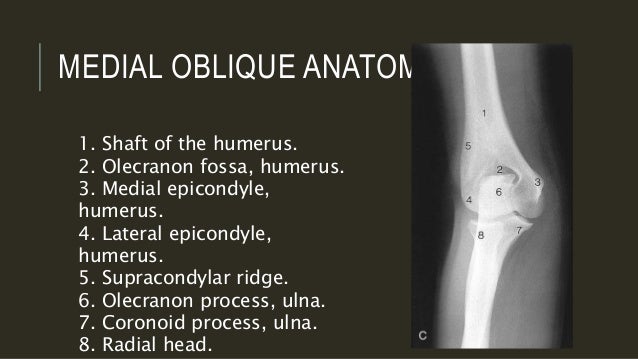 x ray of elbow joint elbow xray