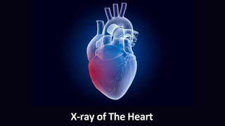 X-ray of The Heart
 