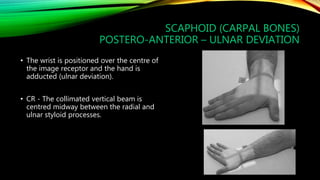 X ray of wrist and hand | PPTX