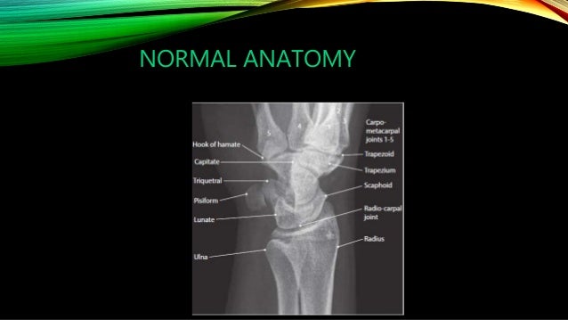 X ray of wrist and hand