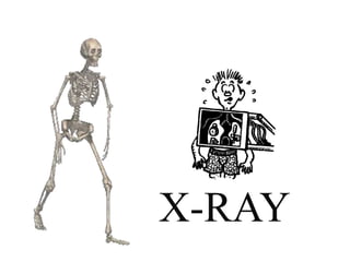X-RAY
 