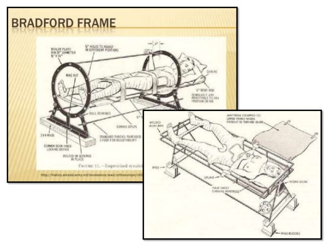 Stryker Wedge Frame Bed Stryker Wedge Frame Bed