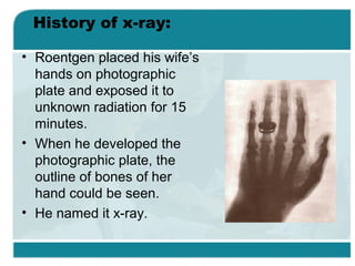 History of x-ray:
• Roentgen placed his wife’s
hands on photographic
plate and exposed it to
unknown radiation for 15
minutes.
• When he developed the
photographic plate, the
outline of bones of her
hand could be seen.
• He named it x-ray.

 