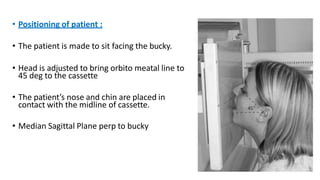 • Positioning of patient :
• The patient is made to sit facing the bucky.
• Head is adjusted to bring orbito meatal line to
45 deg to the cassette
• The patient’s nose and chin are placed in
contact with the midline of cassette.
• Median Sagittal Plane perp to bucky
 