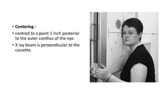 • Centering -
• centred to a point 1 inch posterior
to the outer canthus of the eye.
• X ray beam is perpendicular to the
cassette.
 