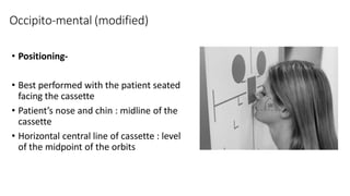 Occipito-mental (modified)
• Positioning-
• Best performed with the patient seated
facing the cassette
• Patient’s nose and chin : midline of the
cassette
• Horizontal central line of cassette : level
of the midpoint of the orbits
 
