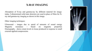 11
X-RAY IMAGING
Other imaging techniques:
Ultrasound - images due to speed of amounts of sound energy
Magnetic resonance – based on magnetic properties
Elastography - shows strain levels in tissue produced in response to small
external applied compressions
Absorption of X-ray and gamma-ray by different material for image:
today, 2-dimensional solid state detectors are used in place of films for X-
ray and gamma-ray imaging as shown in this image.
 