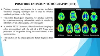 16
POSITRON EMISSION TOMOGRAPHY (PET)
 Positron emission tomography is a nuclear medicine
functional imaging technique that is used to observe
metabolic processes in the body.
 The system detects pairs of gamma rays emitted indirectly
by a positron-emitting radionuclide which is introduced
into the body on a biologically active molecule.
 In modern PET-CT scanners, three dimensional imaging is
often accomplished with the aid of a CT X-ray scan
performed on the patient during the same session, in the
same machine.
 The function of the organs provides better diagnosis than
CT.
 