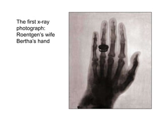 X ray production | PPT