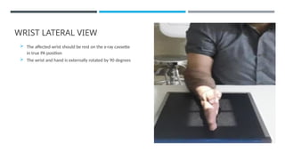 Wrist Lateral Rotation x-ray projections for wrist joint.pptx... | PPTX