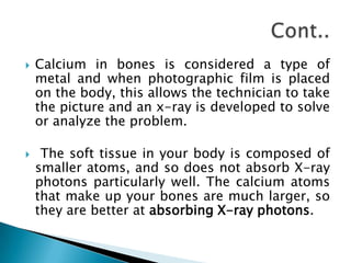 



Calcium in bones is considered a type of
metal and when photographic film is placed
on the body, this allows the technician to take
the picture and an x-ray is developed to solve
or analyze the problem.

The soft tissue in your body is composed of
smaller atoms, and so does not absorb X-ray
photons particularly well. The calcium atoms
that make up your bones are much larger, so
they are better at absorbing X-ray photons.

 