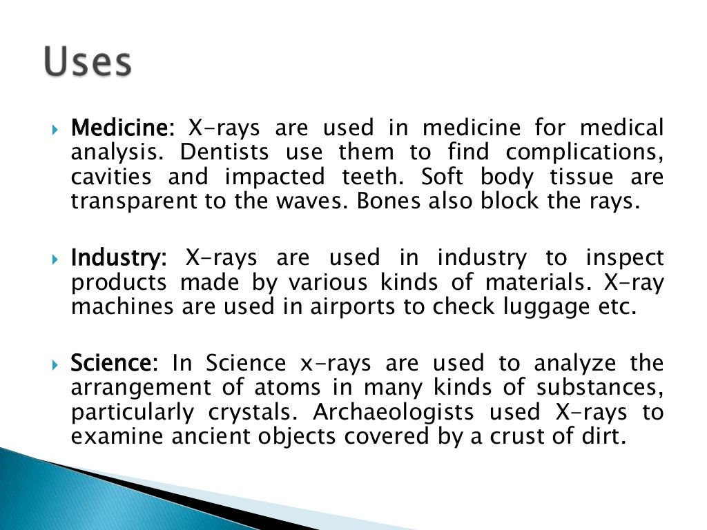 X rays