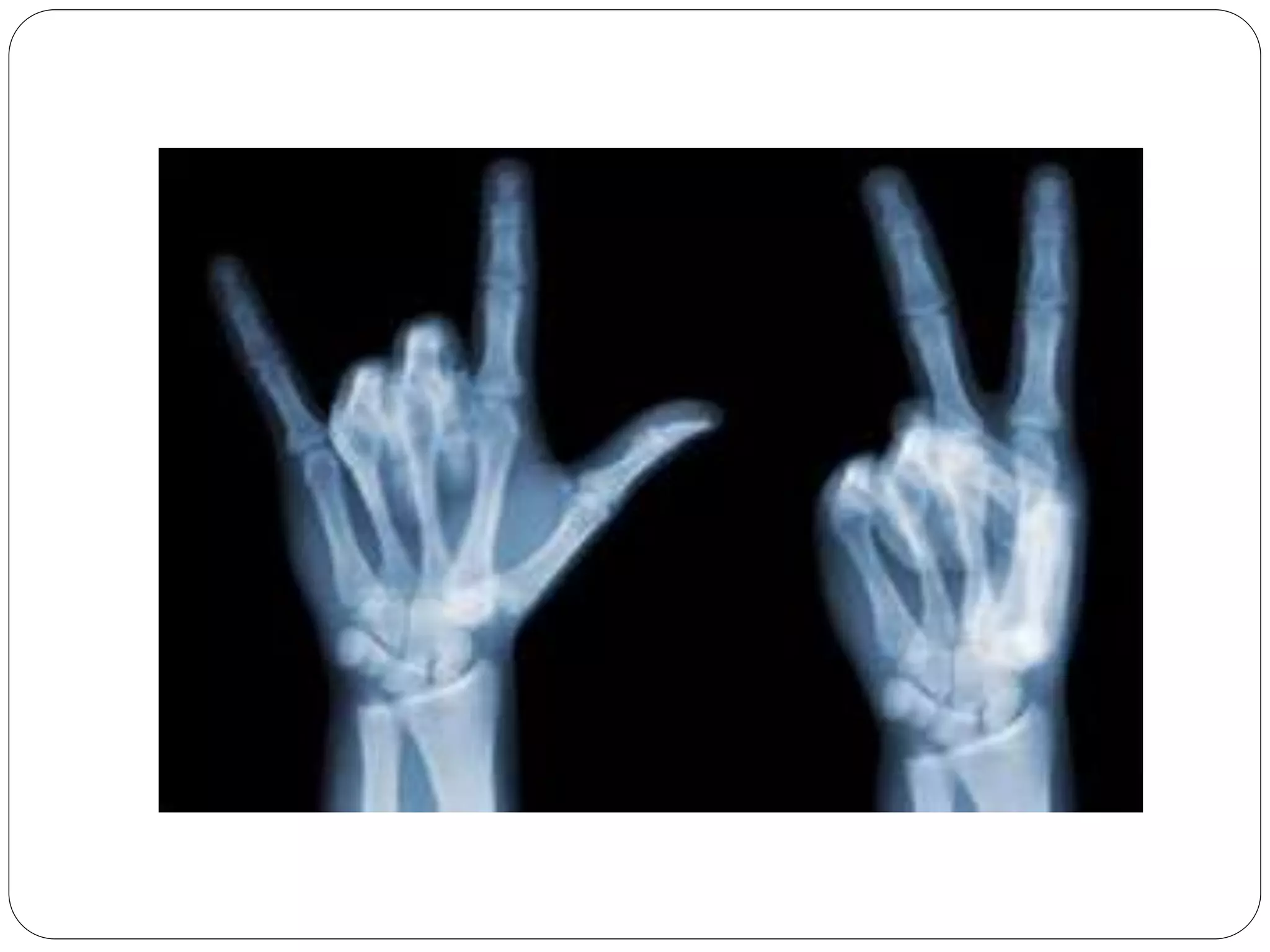 x-rays-ppt