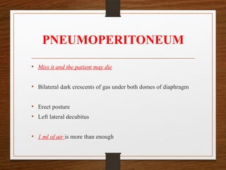 PNEUMOPERITONEUM
• Miss it and the patient may die
• Bilateral dark crescents of gas under both domes of diaphragm
• Erect posture
• Left lateral decubitus
• 1 ml of air is more than enough
 