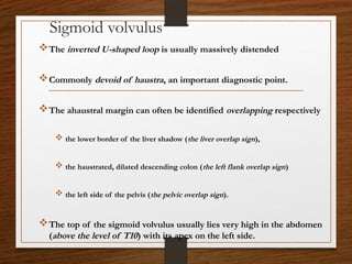 Sigmoid volvulus
The inverted U-shaped loop is usually massively distended
Commonly devoid of haustra, an important diagnostic point.
The ahaustral margin can often be identified overlapping respectively
 the lower border of the liver shadow (the liver overlap sign),
 the haustrated, dilated descending colon (the left flank overlap sign)
 the left side of the pelvis (the pelvic overlap sign).
The top of the sigmoid volvulus usually lies very high in the abdomen
(above the level of T10) with its apex on the left side.
 