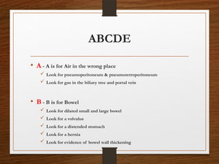 ABCDE
• A - A is for Air in the wrong place
 Look for pneumoperitoneum & pneumoretroperitoneum
 Look for gas in the biliary tree and portal vein
• B - B is for Bowel
 Look for dilated small and large bowel
 Look for a volvulus
 Look for a distended stomach
 Look for a hernia
 Look for evidence of bowel wall thickening
 