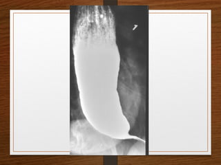 X-Rays.pptx egfhgfegfgefgfigfriegiuergrg