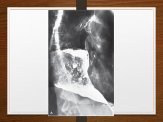 X-Rays.pptx egfhgfegfgefgfigfriegiuergrg