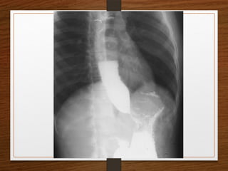 X-Rays.pptx egfhgfegfgefgfigfriegiuergrg