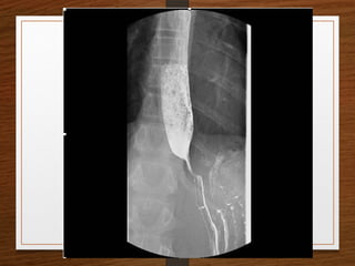 X-Rays.pptx egfhgfegfgefgfigfriegiuergrg