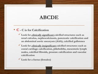 ABCDE
• C - C is for Calcification
 Look for clinically significant calcified structures such as
renal calculus, nephrocalcinosis, pancreatic calcification and
an abdominal aortic aneurysm (AAA), calcified gallstones
 Look for clinically insignificant calcified structures such as
costal cartilage calcification, phleboliths, mesenteric lymph
nodes, calcified fibroids, prostate calcification and vascular
calcification
 Look for a foetus (females)
 