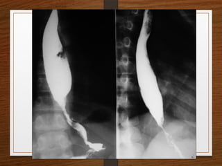 X-Rays.pptx egfhgfegfgefgfigfriegiuergrg