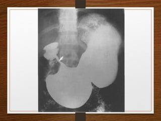 X-Rays.pptx egfhgfegfgefgfigfriegiuergrg