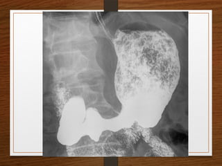 X-Rays.pptx egfhgfegfgefgfigfriegiuergrg