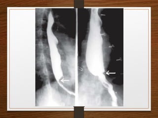 X-Rays.pptx egfhgfegfgefgfigfriegiuergrg