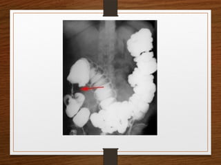 X-Rays.pptx egfhgfegfgefgfigfriegiuergrg