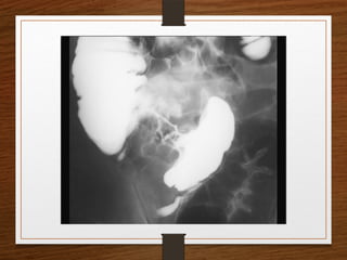 X-Rays.pptx egfhgfegfgefgfigfriegiuergrg