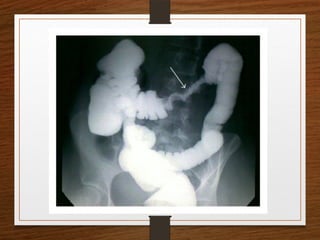 X-Rays.pptx egfhgfegfgefgfigfriegiuergrg