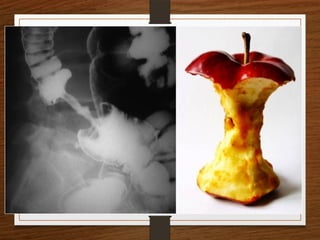 X-Rays.pptx egfhgfegfgefgfigfriegiuergrg